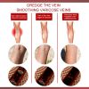 EELHOE Aricose Veins Medical Cream, Leg Swelling Earthworm Leg Vein Massage To
